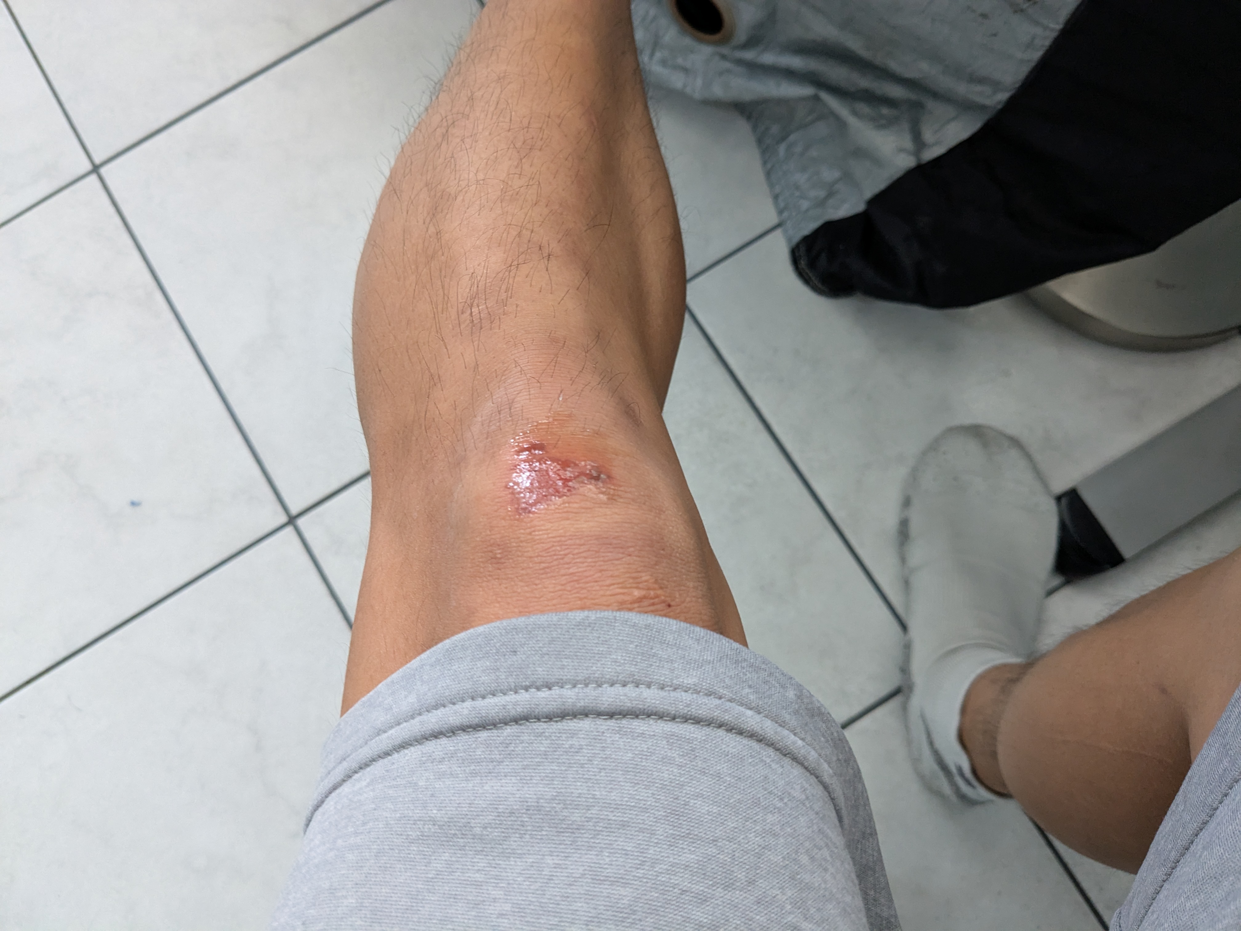 leg